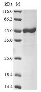(Tris-Glycine gel) Discontinuous SDS-PAGE (reduced) with 5% enrichment gel and 15% separation gel.