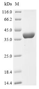 (Tris-Glycine gel) Discontinuous SDS-PAGE (reduced) with 5% enrichment gel and 15% separation gel.