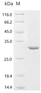 (Tris-Glycine gel) Discontinuous SDS-PAGE (reduced) with 5% enrichment gel and 15% separation gel.