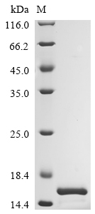 (Tris-Glycine gel) Discontinuous SDS-PAGE (reduced) with 5% enrichment gel and 15% separation gel. (Tris-Glycine gel) Discontinuous SDS-PAGE (reduced) with 5% enrichment gel and 15% separation gel.