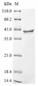 (Tris-Glycine gel) Discontinuous SDS-PAGE (reduced) with 5% enrichment gel and 15% separation gel.