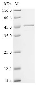 (Tris-Glycine gel) Discontinuous SDS-PAGE (reduced) with 5% enrichment gel and 15% separation gel.