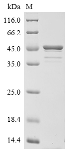(Tris-Glycine gel) Discontinuous SDS-PAGE (reduced) with 5% enrichment gel and 15% separation gel.