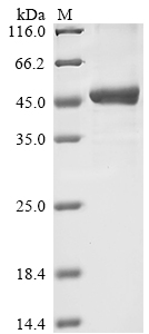 (Tris-Glycine gel) Discontinuous SDS-PAGE (reduced) with 5% enrichment gel and 15% separation gel. (Tris-Glycine gel) Discontinuous SDS-PAGE (reduced) with 5% enrichment gel and 15% separation gel.