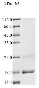 (Tris-Glycine gel) Discontinuous SDS-PAGE (reduced) with 5% enrichment gel and 15% separation gel. (Tris-Glycine gel) Discontinuous SDS-PAGE (reduced) with 5% enrichment gel and 15% separation gel.
