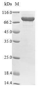 (Tris-Glycine gel) Discontinuous SDS-PAGE (reduced) with 5% enrichment gel and 15% separation gel. (Tris-Glycine gel) Discontinuous SDS-PAGE (reduced) with 5% enrichment gel and 15% separation gel.