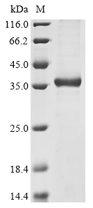 (Tris-Glycine gel) Discontinuous SDS-PAGE (reduced) with 5% enrichment gel and 15% separation gel. (Tris-Glycine gel) Discontinuous SDS-PAGE (reduced) with 5% enrichment gel and 15% separation gel.