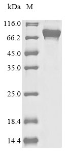 (Tris-Glycine gel) Discontinuous SDS-PAGE (reduced) with 5% enrichment gel and 15% separation gel. (Tris-Glycine gel) Discontinuous SDS-PAGE (reduced) with 5% enrichment gel and 15% separation gel.