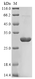 (Tris-Glycine gel) Discontinuous SDS-PAGE (reduced) with 5% enrichment gel and 15% separation gel. (Tris-Glycine gel) Discontinuous SDS-PAGE (reduced) with 5% enrichment gel and 15% separation gel.