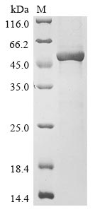 (Tris-Glycine gel) Discontinuous SDS-PAGE (reduced) with 5% enrichment gel and 15% separation gel. (Tris-Glycine gel) Discontinuous SDS-PAGE (reduced) with 5% enrichment gel and 15% separation gel.