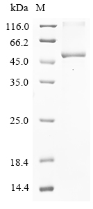 (Tris-Glycine gel) Discontinuous SDS-PAGE (reduced) with 5% enrichment gel and 15% separation gel. (Tris-Glycine gel) Discontinuous SDS-PAGE (reduced) with 5% enrichment gel and 15% separation gel.