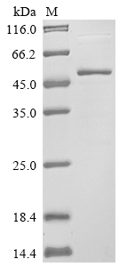 (Tris-Glycine gel) Discontinuous SDS-PAGE (reduced) with 5% enrichment gel and 15% separation gel. (Tris-Glycine gel) Discontinuous SDS-PAGE (reduced) with 5% enrichment gel and 15% separation gel.