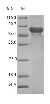 (Tris-Glycine gel) Discontinuous SDS-PAGE (reduced) with 5% enrichment gel and 15% separation gel. (Tris-Glycine gel) Discontinuous SDS-PAGE (reduced) with 5% enrichment gel and 15% separation gel.