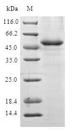 (Tris-Glycine gel) Discontinuous SDS-PAGE (reduced) with 5% enrichment gel and 15% separation gel. (Tris-Glycine gel) Discontinuous SDS-PAGE (reduced) with 5% enrichment gel and 15% separation gel.