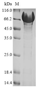 (Tris-Glycine gel) Discontinuous SDS-PAGE (reduced) with 5% enrichment gel and 15% separation gel. (Tris-Glycine gel) Discontinuous SDS-PAGE (reduced) with 5% enrichment gel and 15% separation gel.