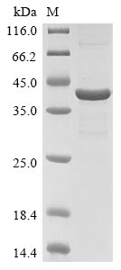 (Tris-Glycine gel) Discontinuous SDS-PAGE (reduced) with 5% enrichment gel and 15% separation gel. (Tris-Glycine gel) Discontinuous SDS-PAGE (reduced) with 5% enrichment gel and 15% separation gel.
