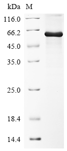 (Tris-Glycine gel) Discontinuous SDS-PAGE (reduced) with 5% enrichment gel and 15% separation gel. (Tris-Glycine gel) Discontinuous SDS-PAGE (reduced) with 5% enrichment gel and 15% separation gel.
