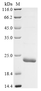 (Tris-Glycine gel) Discontinuous SDS-PAGE (reduced) with 5% enrichment gel and 15% separation gel. (Tris-Glycine gel) Discontinuous SDS-PAGE (reduced) with 5% enrichment gel and 15% separation gel.