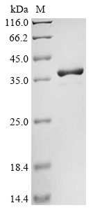 (Tris-Glycine gel) Discontinuous SDS-PAGE (reduced) with 5% enrichment gel and 15% separation gel.