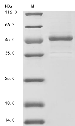 (Tris-Glycine gel) Discontinuous SDS-PAGE (reduced) with 5% enrichment gel and 15% separation gel. (Tris-Glycine gel) Discontinuous SDS-PAGE (reduced) with 5% enrichment gel and 15% separation gel.