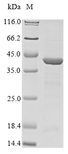 (Tris-Glycine gel) Discontinuous SDS-PAGE (reduced) with 5% enrichment gel and 15% separation gel.
