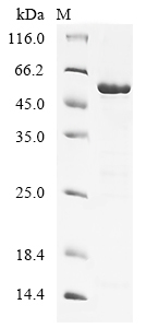 (Tris-Glycine gel) Discontinuous SDS-PAGE (reduced) with 5% enrichment gel and 15% separation gel. (Tris-Glycine gel) Discontinuous SDS-PAGE (reduced) with 5% enrichment gel and 15% separation gel.