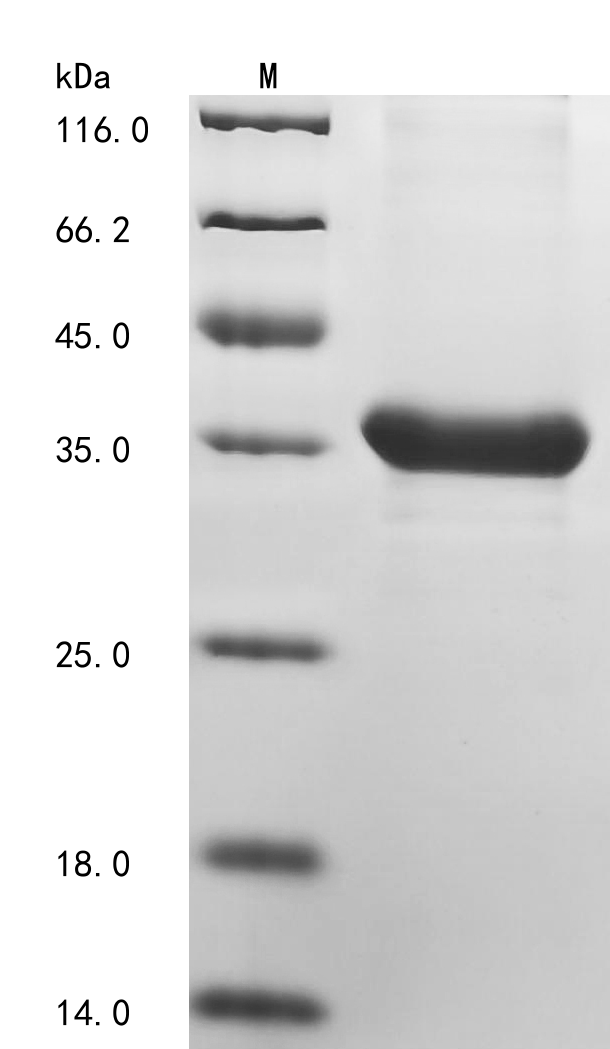 (Tris-Glycine gel) Discontinuous SDS-PAGE (reduced) with 5% enrichment gel and 15% separation gel. (Tris-Glycine gel) Discontinuous SDS-PAGE (reduced) with 5% enrichment gel and 15% separation gel.