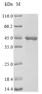 (Tris-Glycine gel) Discontinuous SDS-PAGE (reduced) with 5% enrichment gel and 15% separation gel. (Tris-Glycine gel) Discontinuous SDS-PAGE (reduced) with 5% enrichment gel and 15% separation gel.