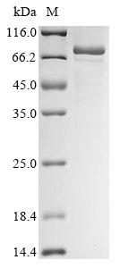 (Tris-Glycine gel) Discontinuous SDS-PAGE (reduced) with 5% enrichment gel and 15% separation gel. (Tris-Glycine gel) Discontinuous SDS-PAGE (reduced) with 5% enrichment gel and 15% separation gel.