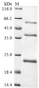 (Tris-Glycine gel) Discontinuous SDS-PAGE (reduced) with 5% enrichment gel and 15% separation gel. (Tris-Glycine gel) Discontinuous SDS-PAGE (reduced) with 5% enrichment gel and 15% separation gel.