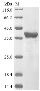 (Tris-Glycine gel) Discontinuous SDS-PAGE (reduced) with 5% enrichment gel and 15% separation gel. (Tris-Glycine gel) Discontinuous SDS-PAGE (reduced) with 5% enrichment gel and 15% separation gel.