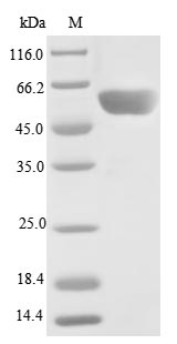 SDS-PAGE- Recombinant protein Human PPP2R2C