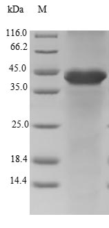 (Tris-Glycine gel) Discontinuous SDS-PAGE (reduced) with 5% enrichment gel and 15% separation gel. (Tris-Glycine gel) Discontinuous SDS-PAGE (reduced) with 5% enrichment gel and 15% separation gel.