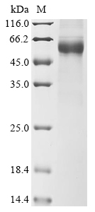 (Tris-Glycine gel) Discontinuous SDS-PAGE (reduced) with 5% enrichment gel and 15% separation gel. (Tris-Glycine gel) Discontinuous SDS-PAGE (reduced) with 5% enrichment gel and 15% separation gel.