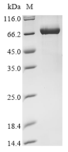 (Tris-Glycine gel) Discontinuous SDS-PAGE (reduced) with 5% enrichment gel and 15% separation gel. (Tris-Glycine gel) Discontinuous SDS-PAGE (reduced) with 5% enrichment gel and 15% separation gel.