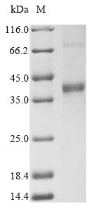 (Tris-Glycine gel) Discontinuous SDS-PAGE (reduced) with 5% enrichment gel and 15% separation gel.