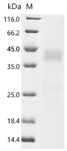 (Tris-Glycine gel) Discontinuous SDS-PAGE (reduced) with 5% enrichment gel and 15% separation gel.