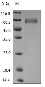 CSB-MP002831HU1 SDS-PAGE