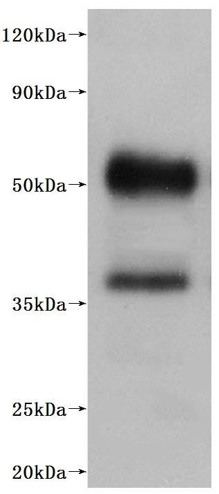 CSB-MP003996HU-WB