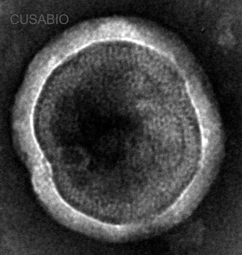 CSB-MP004847HU-TEM1