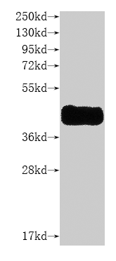 CSB-MP004847HU-WB2