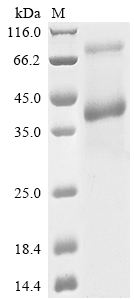 (Tris-Glycine gel) Discontinuous SDS-PAGE (reduced) with 5% enrichment gel and 15% separation gel. (Tris-Glycine gel) Discontinuous SDS-PAGE (reduced) with 5% enrichment gel and 15% separation gel.