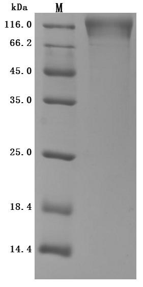 CSB-MP004971HU1(F2) SDS-PAGE