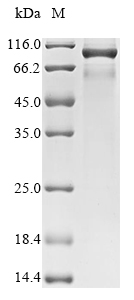 (Tris-Glycine gel) Discontinuous SDS-PAGE (reduced) with 5% enrichment gel and 15% separation gel. (Tris-Glycine gel) Discontinuous SDS-PAGE (reduced) with 5% enrichment gel and 15% separation gel.
