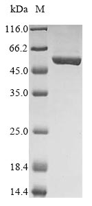(Tris-Glycine gel) Discontinuous SDS-PAGE (reduced) with 5% enrichment gel and 15% separation gel. (Tris-Glycine gel) Discontinuous SDS-PAGE (reduced) with 5% enrichment gel and 15% separation gel.
