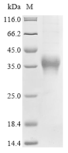 (Tris-Glycine gel) Discontinuous SDS-PAGE (reduced) with 5% enrichment gel and 15% separation gel. (Tris-Glycine gel) Discontinuous SDS-PAGE (reduced) with 5% enrichment gel and 15% separation gel.