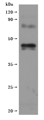 CSB-MP005678HU WB