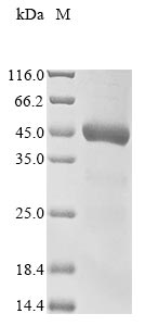 (Tris-Glycine gel) Discontinuous SDS-PAGE (reduced) with 5% enrichment gel and 15% separation gel. (Tris-Glycine gel) Discontinuous SDS-PAGE (reduced) with 5% enrichment gel and 15% separation gel.