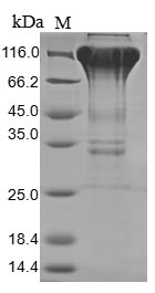 SDS-PAGE- Recombinant protein Human CSF1R