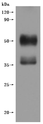 CSB-MP006254HU(F1)-WB